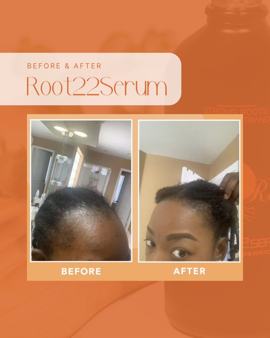 Your Scalp is Healthy - Keep the Momentum Going with Vigor Roots