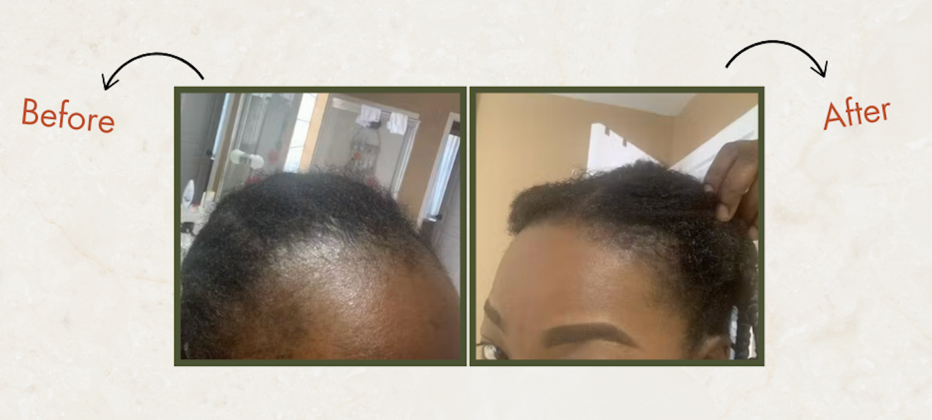 Your Hair Growth Journey: Why Quick Fixes Don’t Work