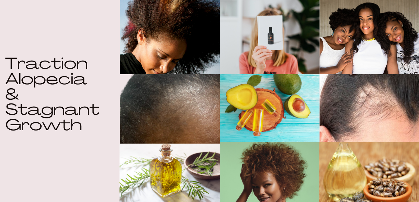 Use Scalp Care to Treating Traction Alopecia and Stagnant Hair Growth